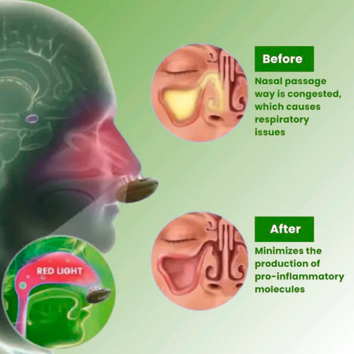 ComfyNas™ - Comfortable Nasal Solution