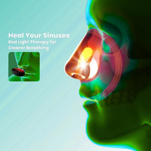 ComfyNas™ - Comfortable Nasal Solution